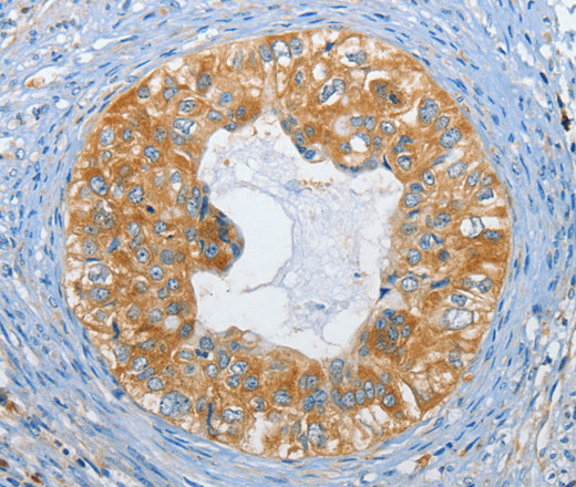 DGK zeta Polyclonal Antibody (E-AB-16203)