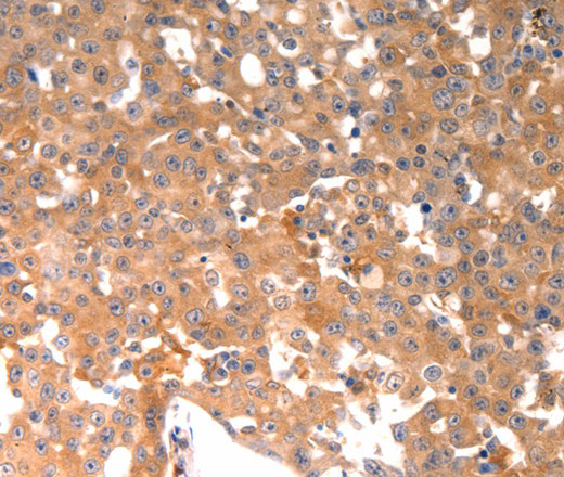 BGLAP Polyclonal Antibody (E-AB-12296)