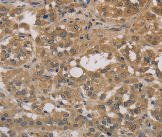 DEGS1 Polyclonal Antibody (E-AB-14946)
