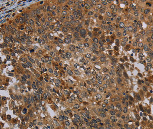 OSM Polyclonal Antibody (E-AB-16669)