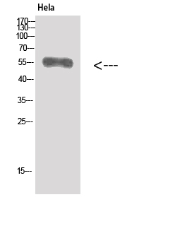 Vimentin Polyclonal Antibody (E-AB-36172)