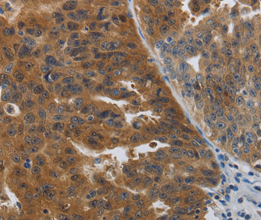 PDCD2 Polyclonal Antibody (E-AB-12836)