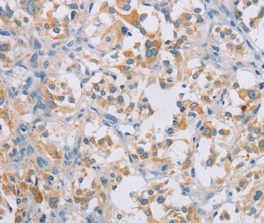 CERKL Polyclonal Antibody (E-AB-13147)