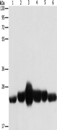 CAV1 Polyclonal Antibody (E-AB-13048)