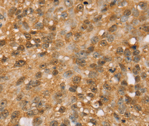 MED22 Polyclonal Antibody (E-AB-11617)