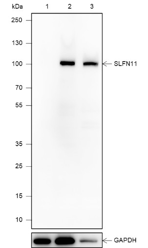 Recombinant SLFN11 Monoclonal Antibody (AN301870L)