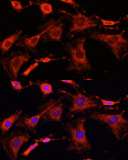 IRAK1 Polyclonal Antibody (E-AB-64288)
