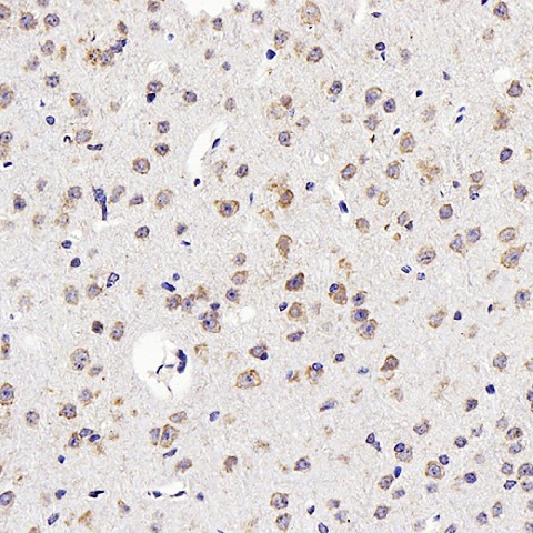 GDNF Polyclonal Antibody (E-AB-70291)