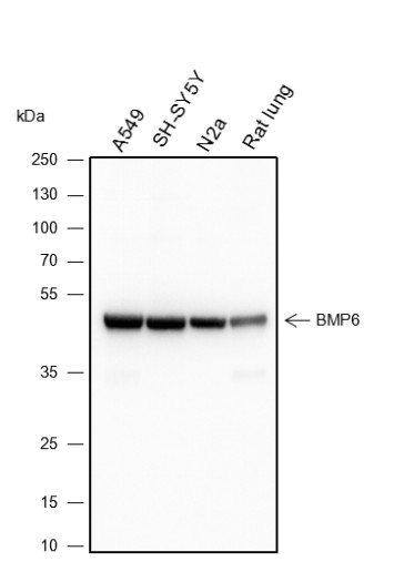 Recombinant BMP6 Monoclonal Antibody (AN301448L)