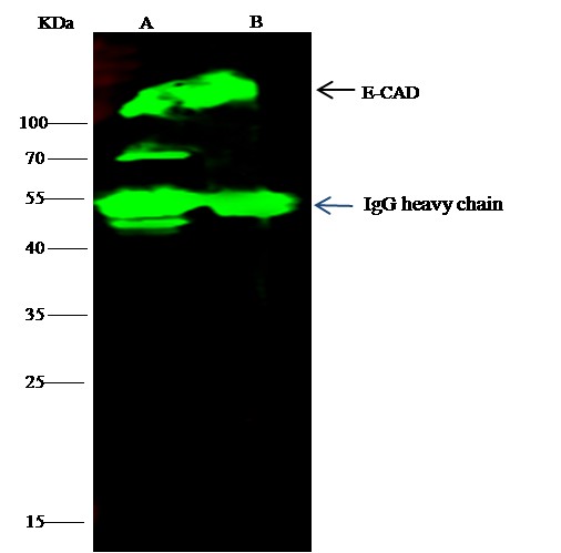 Recombinant E-Cadherin/CDH1/E-cad/CD324 Monoclonal Antibody (AN300024P)