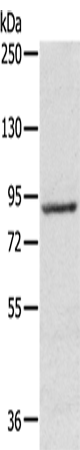 RPS6KA1 Polyclonal Antibody (E-AB-15365)