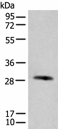 CFHR2 Polyclonal Antibody (E-AB-52540)