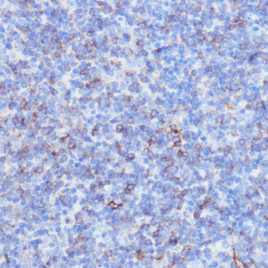 NOTCH3 Polyclonal Antibody (E-AB-66095)