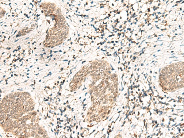 SNRPG Polyclonal Antibody (E-AB-18074)