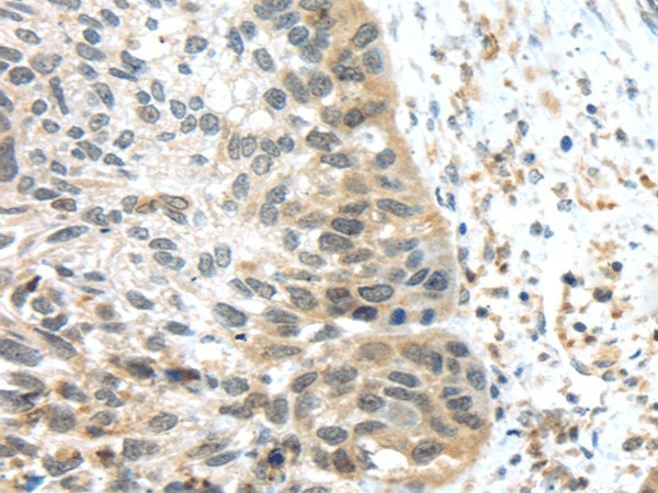 TSPY1/3 Polyclonal Antibody (E-AB-17476)