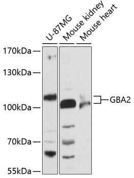 GBA2 Polyclonal Antibody (E-AB-90504)