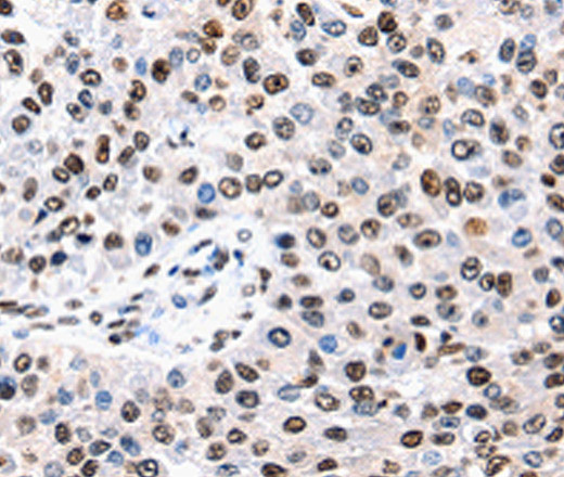 AQP2 Polyclonal Antibody (E-AB-15510)