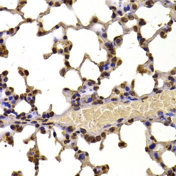 WHSC1 Polyclonal Antibody (E-AB-62262)