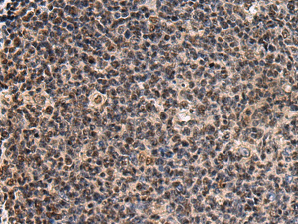 SIK3 Polyclonal Antibody (E-AB-19266)
