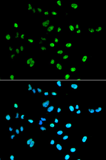 PAX2 Polyclonal Antibody (E-AB-60827)
