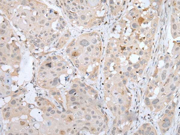 BORCS8 Polyclonal Antibody (E-AB-53509)
