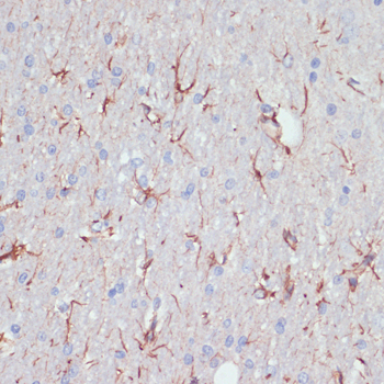 GFAP Polyclonal Antibody (E-AB-65069)