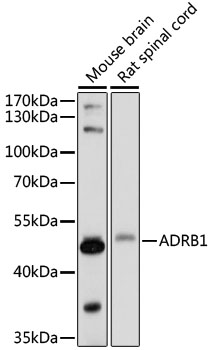 ADRB1 Polyclonal Antibody (E-AB-91503)