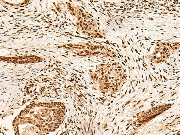 PAFAH1B2 Polyclonal Antibody (E-AB-18951)