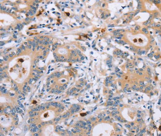 KLK4 Polyclonal Antibody (E-AB-14180)