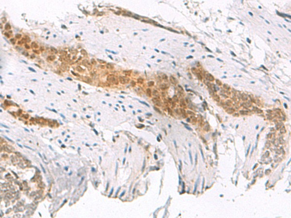 SCAND1 Polyclonal Antibody (E-AB-52831)