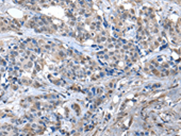 ZFP2 Polyclonal Antibody (E-AB-18323)