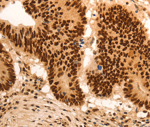 E2F7 Polyclonal Antibody (E-AB-12376)