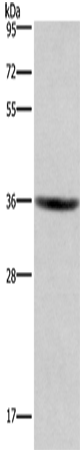GPR171 Polyclonal Antibody (E-AB-13278)