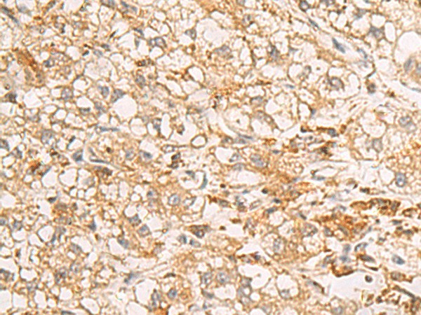 RAB38 Polyclonal Antibody (E-AB-53087)