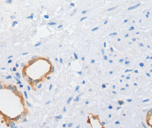 MUC5AC Polyclonal Antibody (E-AB-15787)