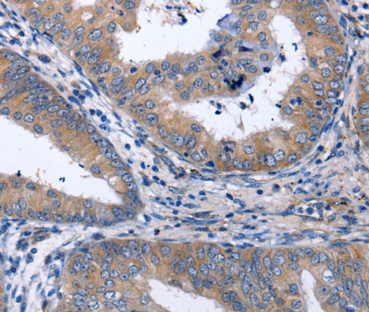NPPB Polyclonal Antibody (E-AB-12298)