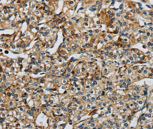 PERK Polyclonal Antibody (E-AB-16703)