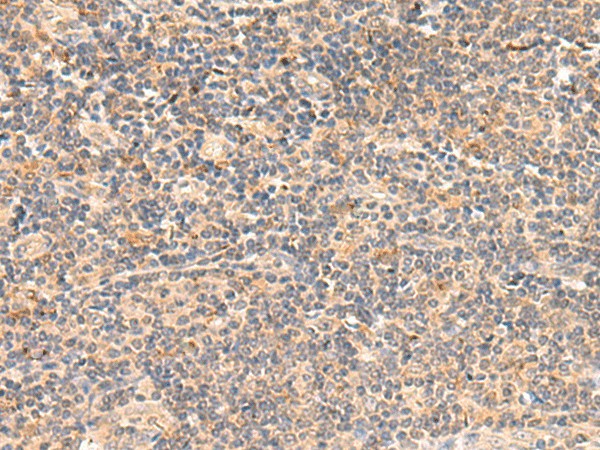 TEAD3 Polyclonal Antibody (E-AB-18977)