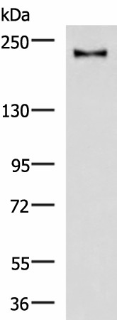 KIF21B Polyclonal Antibody (E-AB-18193)