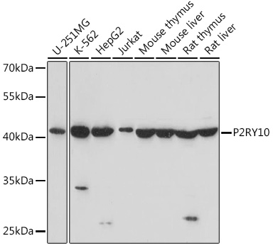 P2RY10 Polyclonal Antibody (E-AB-91563)