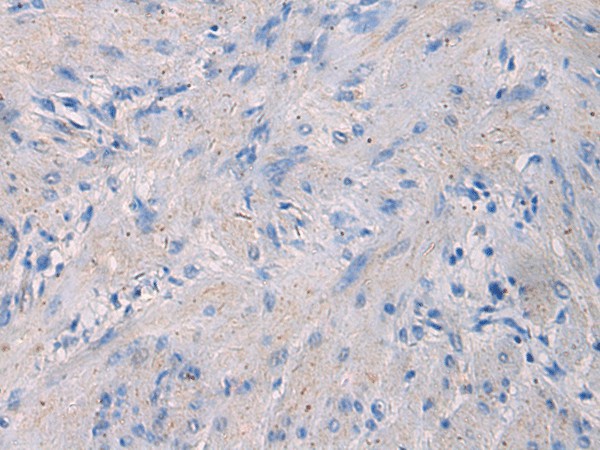 NFKB1 Polyclonal Antibody (E-AB-52131)