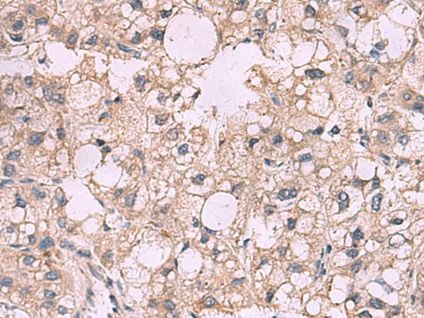 KCNIP1 Polyclonal Antibody (E-AB-52076)