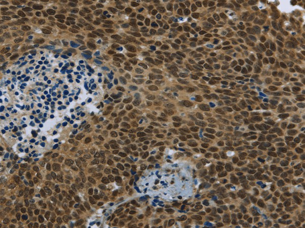 SMAD4 Polyclonal Antibody (E-AB-16957)