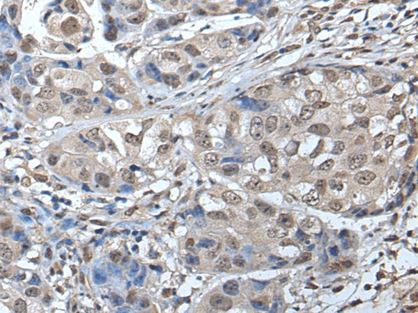 SMC1A Polyclonal Antibody (E-AB-18291)