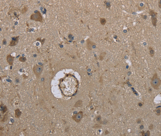 MARK4 Polyclonal Antibody (E-AB-13402)