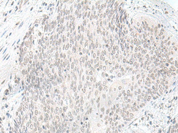 ORC1 Polyclonal Antibody (E-AB-52668)