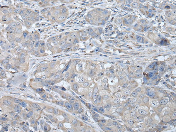 RASA1 Polyclonal Antibody (E-AB-18279)