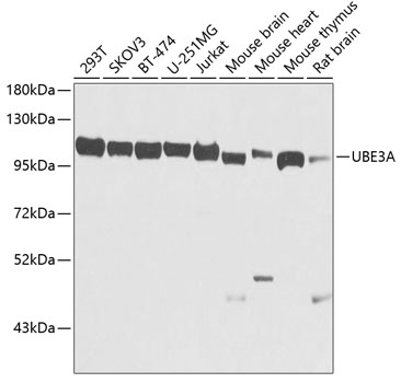 UBE3A Polyclonal Antibody (E-AB-62254)