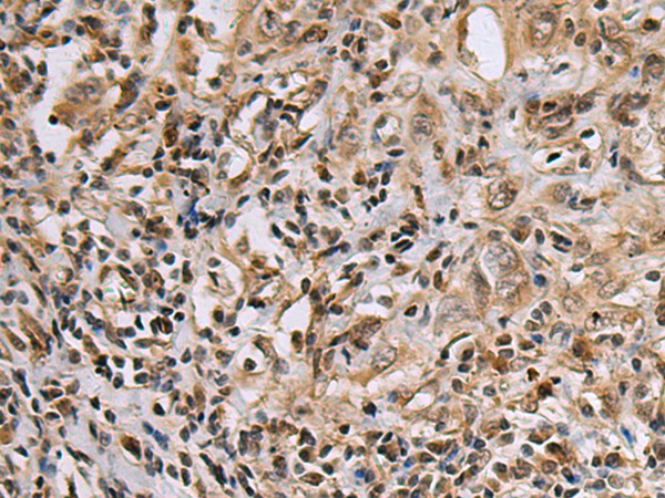 DNA2 Polyclonal Antibody (E-AB-53190)