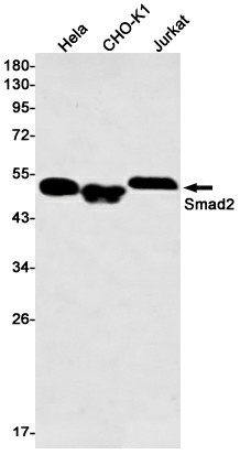 Recombinant Smad2 Monoclonal Antibody (E-AB-81486)